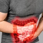 Iritasi usus atau IBS adalah kondisi kronis yang mempengaruhi usus besar, menyebabkan gejala seperti kram perut, diare, dan sembelit